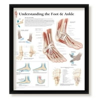 Set uokvirenog medicinskog plakata Razumijevanje artritisa, ručnog i zgloba, ramena i lakta, stopala