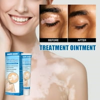 White TAG tretman hidratantna krema smanjuje bijele spotove blede kožom oznake kože vitiligo briga za